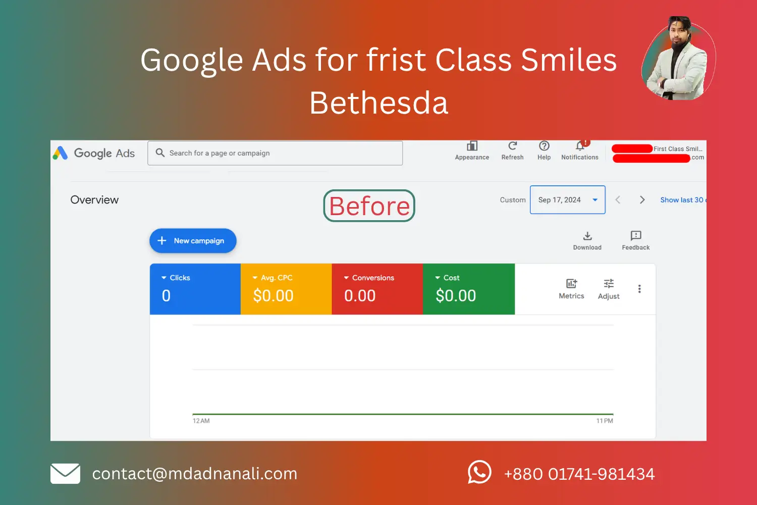 Before Google Ads for frist Class Smiles Bethesda (2)