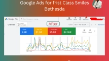 After Google Ads for frist Class Smiles Bethesda