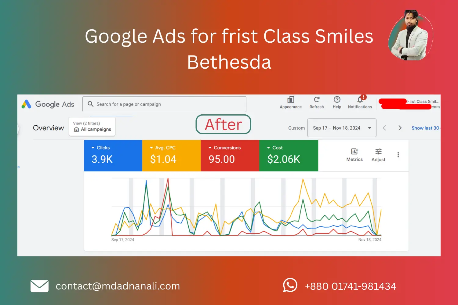 After Google Ads for frist Class Smiles Bethesda
